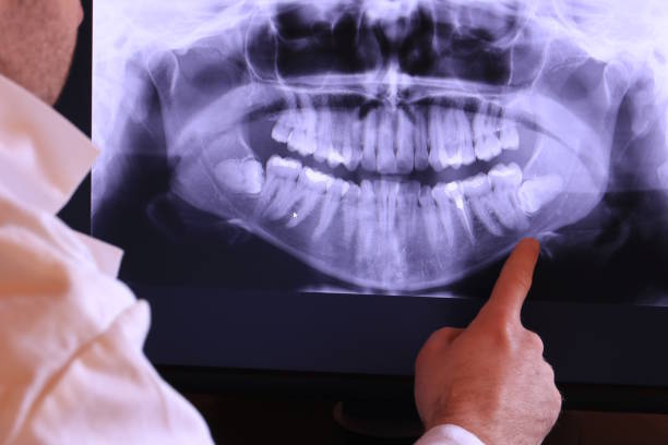 Best Walk-In Emergency Dentist in Carlton, OR